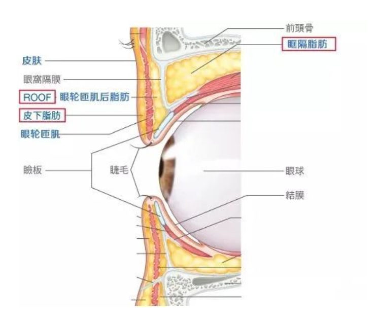 腫泡眼是什麼(me)樣子的