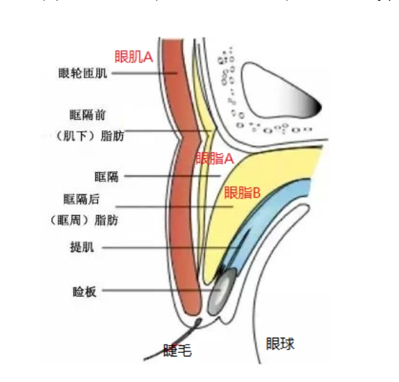 腫泡眼怎樣才能(néng)徹底消除