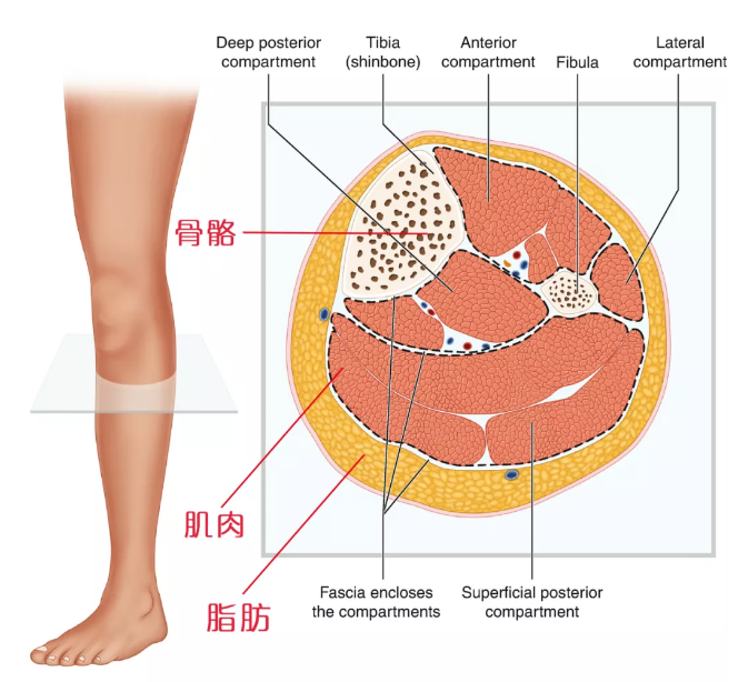 瘦小腿